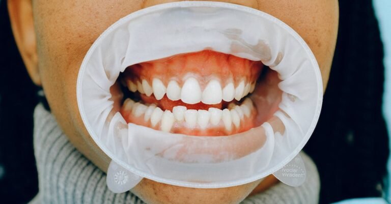 Use This Advice To Get Your Teeth Whiter